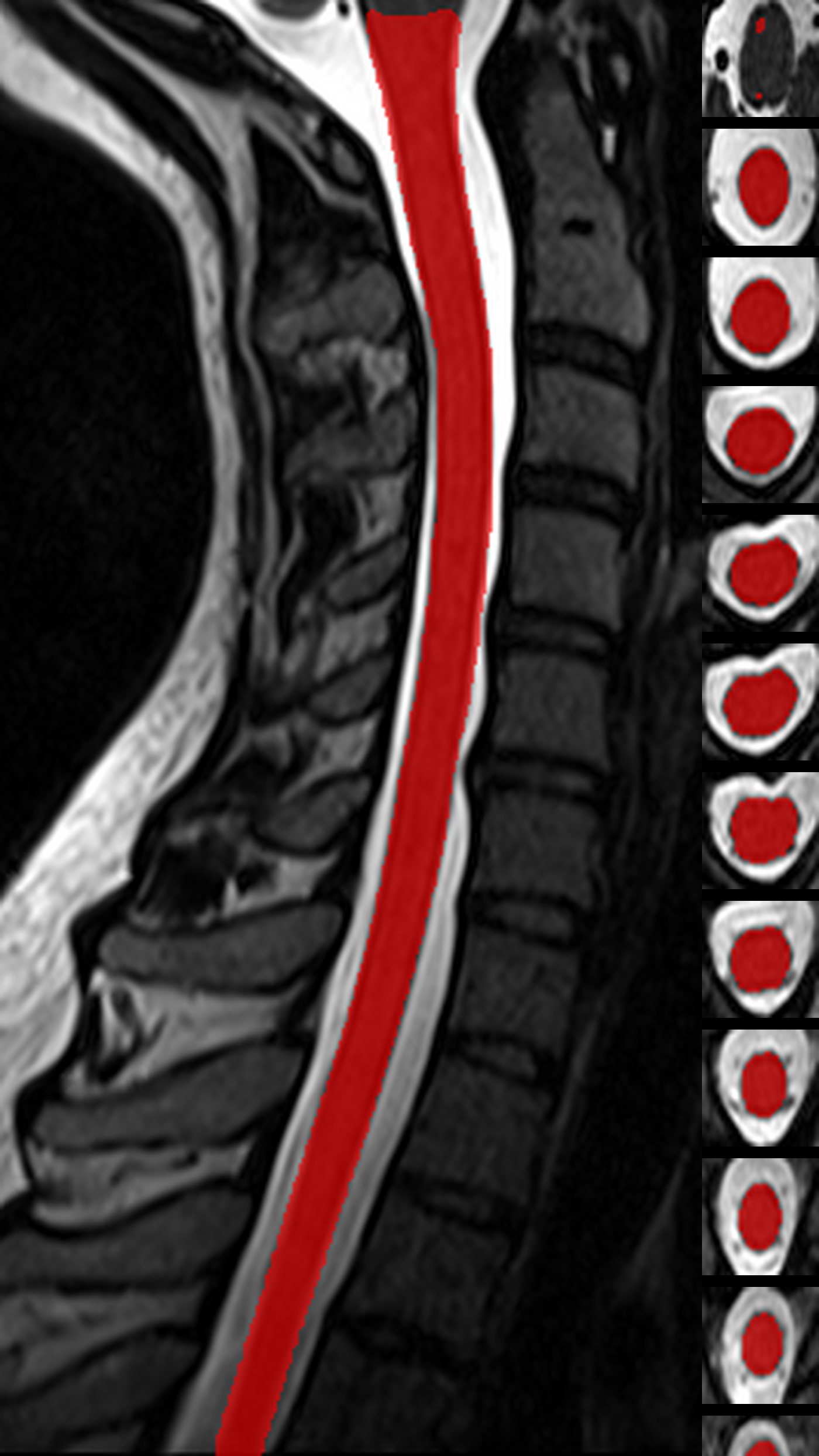 Cord segmentation montage reportlet