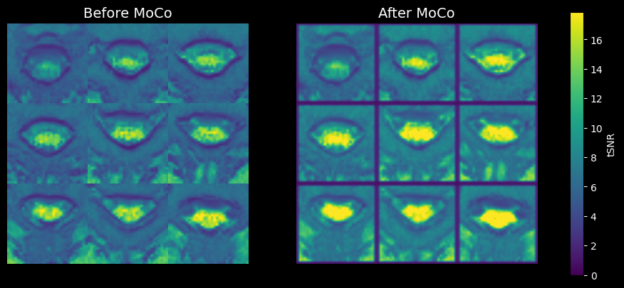 Temporal SNR before and after preprocessing